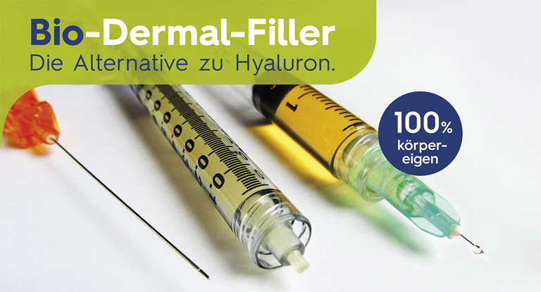 Faltenunterspritzung mit Plasma-Gel Bild